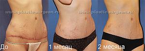     
: c12531a0.jpg
: 112
:	109,5 
ID:	252300