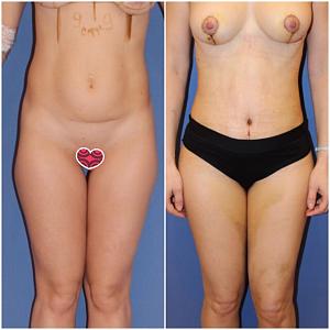 ������� �� ����������� ��� ����������
��������: 0e536999.jpg
����������: 116
������:	105,4 ��
ID:	253250