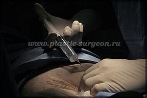     
: a90e35cb.jpg
: 49
:	46,1 
ID:	253753