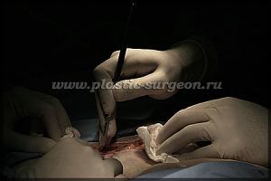     
: 10fe8f4b.jpg
: 54
:	42,0 
ID:	253754
