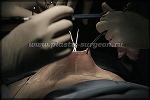     
: 7388ded8.jpg
: 52
:	47,6 
ID:	253755