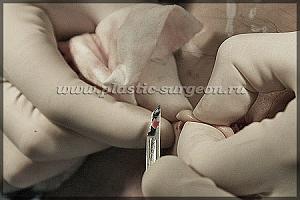     
: 140bcb1c.jpg
: 57
:	60,4 
ID:	253805