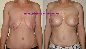     
: eb2658a2.jpg
: 62
:	55,3 
ID:	253836