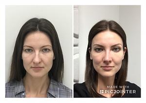 ������� �� ����������� ��� ����������
��������: 0670758a.jpg
����������: 368
������:	63,9 ��
ID:	255333