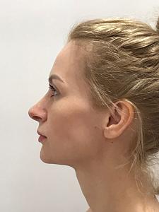 ������� �� ����������� ��� ����������
��������: 7ba08873.jpg
����������: 48
������:	39,2 ��
ID:	260490