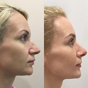 ������� �� ����������� ��� ����������
��������: 60e6b326.jpg
����������: 54
������:	48,0 ��
ID:	260513