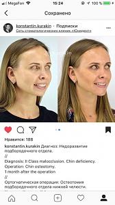     
: 6add0b17.jpg
: 131
:	55,9 
ID:	267575