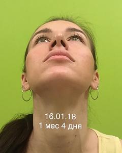     
: 0fbeea91.jpg
: 50
:	35,6 
ID:	267804