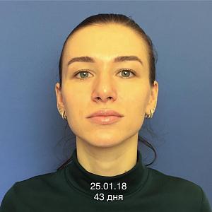     
: a90b4087.jpg
: 113
:	42,4 
ID:	267805