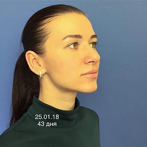     
: ac1923bd.jpg
: 49
:	45,3 
ID:	267809