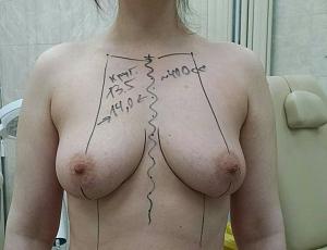     
: ffb19bb9.jpg
: 183
:	63,9 
ID:	268144