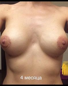     
: 8fe44dc2.jpg
: 125
:	84,6 
ID:	271159