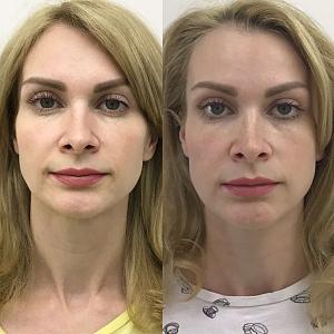 ������� �� ����������� ��� ����������
��������: acd32565.jpg
����������: 49
������:	66,6 ��
ID:	278480