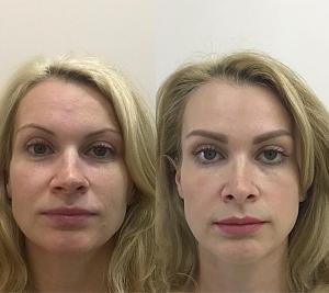 ������� �� ����������� ��� ����������
��������: ca930117.jpg
����������: 45
������:	62,0 ��
ID:	278485