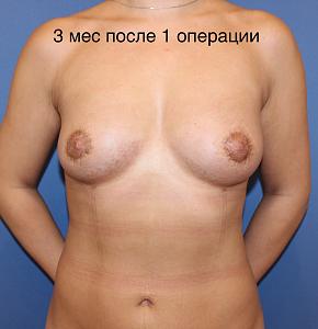     
: c1478aa4.jpg
: 332
:	47,3 
ID:	278683