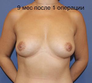     
: ad4e6f29.jpg
: 327
:	48,9 
ID:	278684
