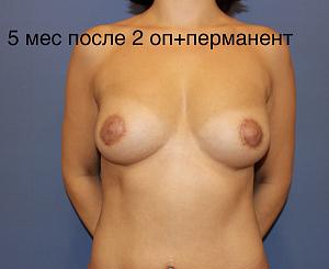     
: 963f4341.jpg
: 381
:	52,0 
ID:	278686