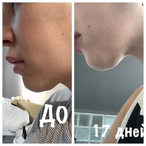 ������� �� ����������� ��� ����������
��������: ff50f818.jpg
����������: 62
������:	36,3 ��
ID:	282079