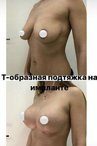     
: d5a38f54.jpg
: 269
:	20,9 
ID:	282747
