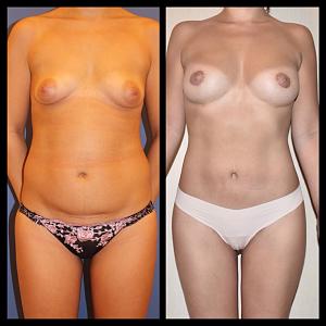 ������� �� ����������� ��� ����������
��������: 4efc8c46.jpg
����������: 68
������:	52,9 ��
ID:	284446