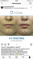 ������� �� ����������� ��� ����������
��������: 8663d146.jpg
����������: 420
������:	55,3 ��
ID:	292429