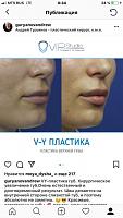 ������� �� ����������� ��� ����������
��������: f0eb1866.jpg
����������: 406
������:	48,6 ��
ID:	292430