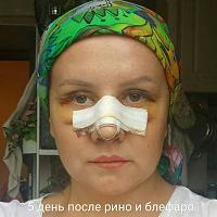    
: cd03a0e5.jpg
: 96
:	43,6 
ID:	293147