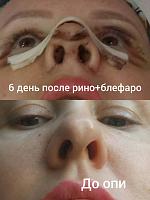     
: fefaf89b.jpg
: 120
:	27,6 
ID:	293664