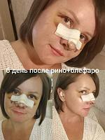     
: bfc8116f.jpg
: 118
:	36,0 
ID:	293665