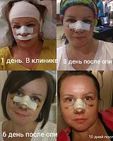     
: 394f2dcd.jpg
: 127
:	40,8 
ID:	296626