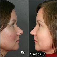     
: e52a2c8c.jpg
: 248
:	35,5 
ID:	309169