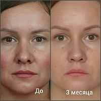     
: 59578e5f.jpg
: 300
:	37,2 
ID:	309170