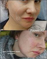     
: 26b29ce5.jpg
: 1012
:	31,5 
ID:	309568