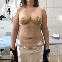     
: 3fa4cc41.jpg
: 226
:	36,5 
ID:	314386