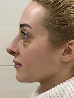     
: bbbc61f2.jpg
: 143
:	194,1 
ID:	315585