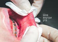     
: 93925a45.jpg
: 247
:	100,0 
ID:	316938