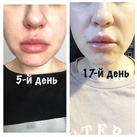 ������� �� ����������� ��� ����������
��������: 4debec54.jpg
����������: 134
������:	59,4 ��
ID:	319291