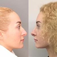 ������� �� ����������� ��� ����������
��������: 7313b302.jpg
����������: 169
������:	192,9 ��
ID:	319534