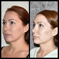 ������� �� ����������� ��� ����������
��������: dc01641f.jpg
����������: 182
������:	67,9 ��
ID:	321356