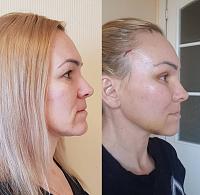 ������� �� ����������� ��� ����������
��������: 0d57ea13.jpg
����������: 209
������:	43,9 ��
ID:	326735