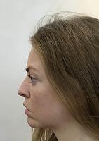     
: c3371481.jpg
: 168
:	43,6 
ID:	329491