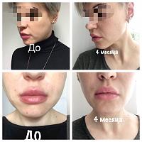 ������� �� ����������� ��� ����������
��������: 50a07165.jpg
����������: 308
������:	60,2 ��
ID:	334551