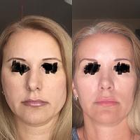 ������� �� ����������� ��� ����������
��������: 99d32093.jpg
����������: 160
������:	52,8 ��
ID:	336894