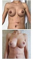     
: 900a1e4f.jpg
: 264
:	72,5 
ID:	341740