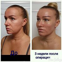 ������� �� ����������� ��� ����������
��������: 0095197c.jpg
����������: 376
������:	38,8 ��
ID:	359741