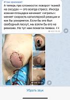     
: 7d5426e8.jpg
: 250
:	100,7 
ID:	367016