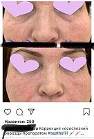 ������� �� ����������� ��� ����������
��������: 0f8a3dac.jpg
����������: 163
������:	53,9 ��
ID:	370322