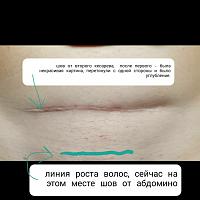 ������� �� ����������� ��� ����������
��������: 2580067a.jpg
����������: 226
������:	32,1 ��
ID:	374490
