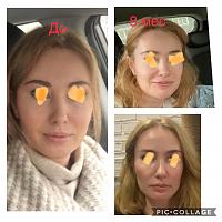 ������� �� ����������� ��� ����������
��������: 0529ee56.jpg
����������: 286
������:	62,6 ��
ID:	379474