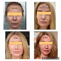 ������� �� ����������� ��� ����������
��������: 78d74af0.jpg
����������: 458
������:	69,8 ��
ID:	381160